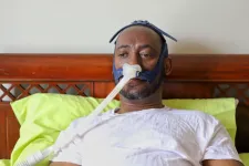 The severity of sleep apnea may be underestimated in Black patients