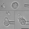 The typhoid fever pathogen uses a cloaking mechanism to evade neutrophil neutralization