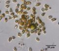 They hunt, they kill, they cheat: Single-celled algae shed light on social lives of microbes