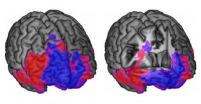 Thinking and choosing in the brain