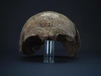 This 5,000-year-old man had the earliest known strain of plague