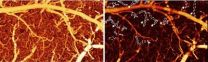 This is your brains blood vessels on drugs