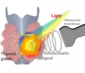 Thyroid cancer now diagnosed with machine learning-powered photoacoustic/ultrasound imaging