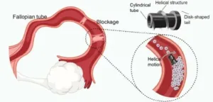 Tiny robots, big impact: Revolutionizing infertility treatment with magnetic microrobots