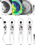 Total-body PET imaging exceeds industry standards