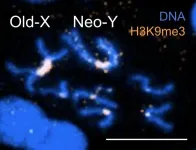 Toxic masculinity: Y chromosome contributes to a shorter lifespan in male flies