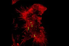 Training immune cells to remove ‘trash’ helps resolve lung inflammation