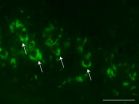 Transmission of tangles in Alzheimers mice provides more authentic model of tau pathology