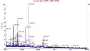 Treating Alzheimers disease with Yizhijiannao granules by inhibiting neuronal apoptosis