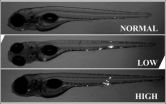 Treatment for tuberculosis can be guided by patients genetics