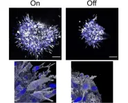 Treatment of aggressive breast cancer: discovery of a new protein involved in the development of metastases