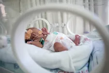 Trial aims to improve treatment for newborns with life-threatening sepsis