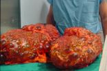 Two drugs are no more effective than 1 to treat common kidney disease