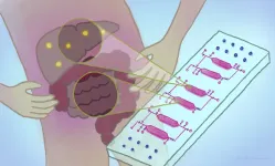 Two-organ chip to answer fatty liver questions