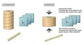 Type 2 diabetes alters the behavior of discs in the vertebral column 2