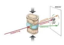 Type 2 diabetes alters the behavior of discs in the vertebral column 3