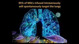 UC-MSC infusion helps repair COVID-19 damage in severe cases