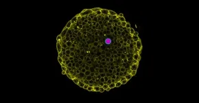 UC Santa Barbara researchers can now visualize osmotic pressure in living tissue