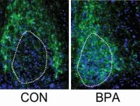 UCalgary study shows BPA exposure below regulatory levels can impact brain development