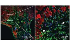 UCLA researchers engineer experimental drug for preventing heart failure after heart attacks