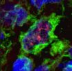 UCLA scientists identify novel pathway for T-cell activation in leprosy