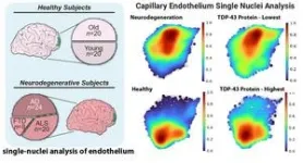 UConn uncovers new clue on what is leading to neurodegenerative diseases like Alzheimer’s and ALS 3