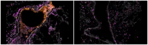 Ultra-low doses of inhaled nanobodies effective against COVID-19 in hamsters