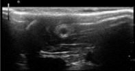 Ultrasound imaging of chitosan nerve conduits that bridge sciatic nerve defects in rats