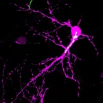 Uncovering how the Golgi apparatus impacts early postnatal neuron development