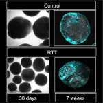 Uncovering the genetic mechanism behind Rett syndrome