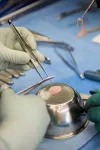 University of Basel delivers first biological implants for treatment of cartilage lesions and osteoarthritis in humans 2