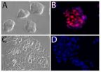 University of Toronto cell biologists discover on-off switch for key stem cell gene