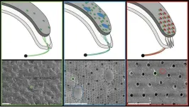 Unraveling the mystery of chiton visual systems