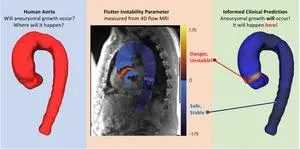 Unstable ‘fluttering’ predicts aortic aneurysm 2