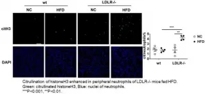 Using mice to open the way to prevent blocked arteries