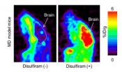 Using PET scanning to evaluate therapies of Menkes disease