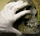 Vikings in Sweden suffered from tooth decay