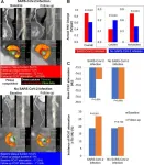 Virus that causes COVID-19 increases risk of cardiac events