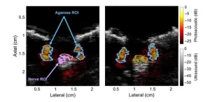 Visualizing nerves with photoacoustic imaging