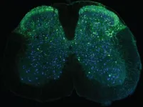 Wearable microscopes advance spinal cord imaging in mice 3