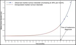 When does a melanoma metastasize? Implications for management