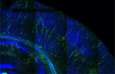 When faster is not better: New study links premature development of human neurons to brain developmental disorders