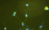 Who reprograms rat astrocytes into neurons?