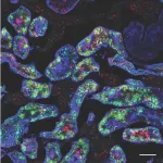 Why are male kidneys more vulnerable to disease than female kidneys? USC Stem Cell-led mouse study points to testosterone