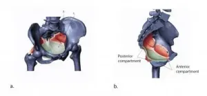 Why the human body has not evolved to make childbirth easier -- or has it?