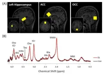 Women with depression have 20% lower taurine concentration in the hippocampus