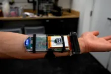 Wristband enables wearers to control a robotic hand with their own movements 2