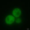 Yeast are first cells known to cure themselves of prions 2