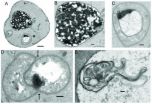 Yeast cell reaction to Zoloft suggests alternative cause, drug target for depression