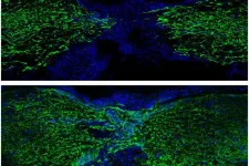 Zebrafish use surprising strategy to regrow spinal cord